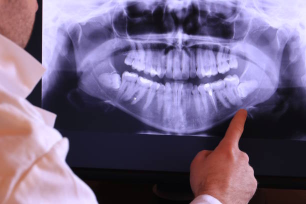 Best Emergency Treatment for Oral Infections in Torrington, CT