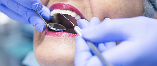 Best Walk-In Emergency Dental Services in Torrington, CT